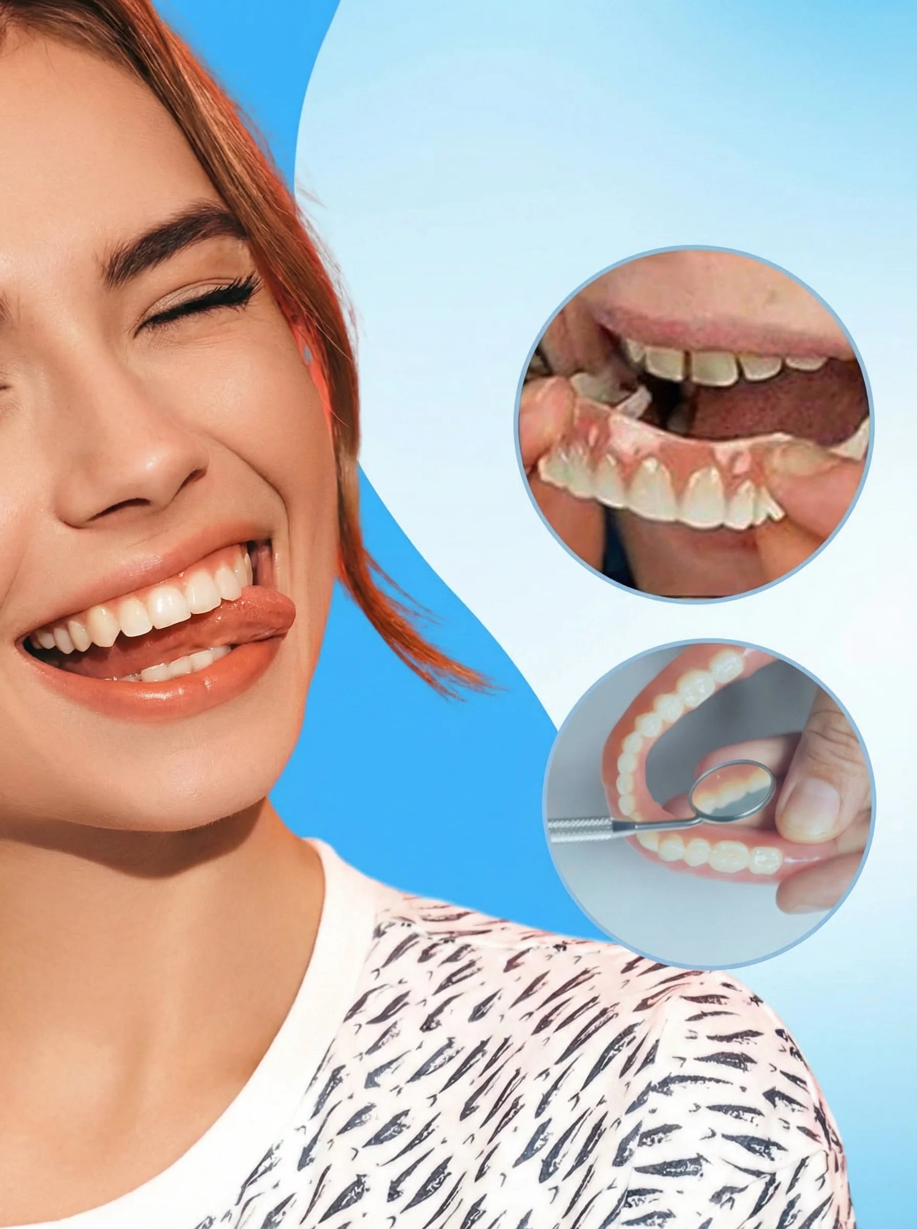 Temporary Veneers | Snap On Veneers-Denture-Pick NewYork