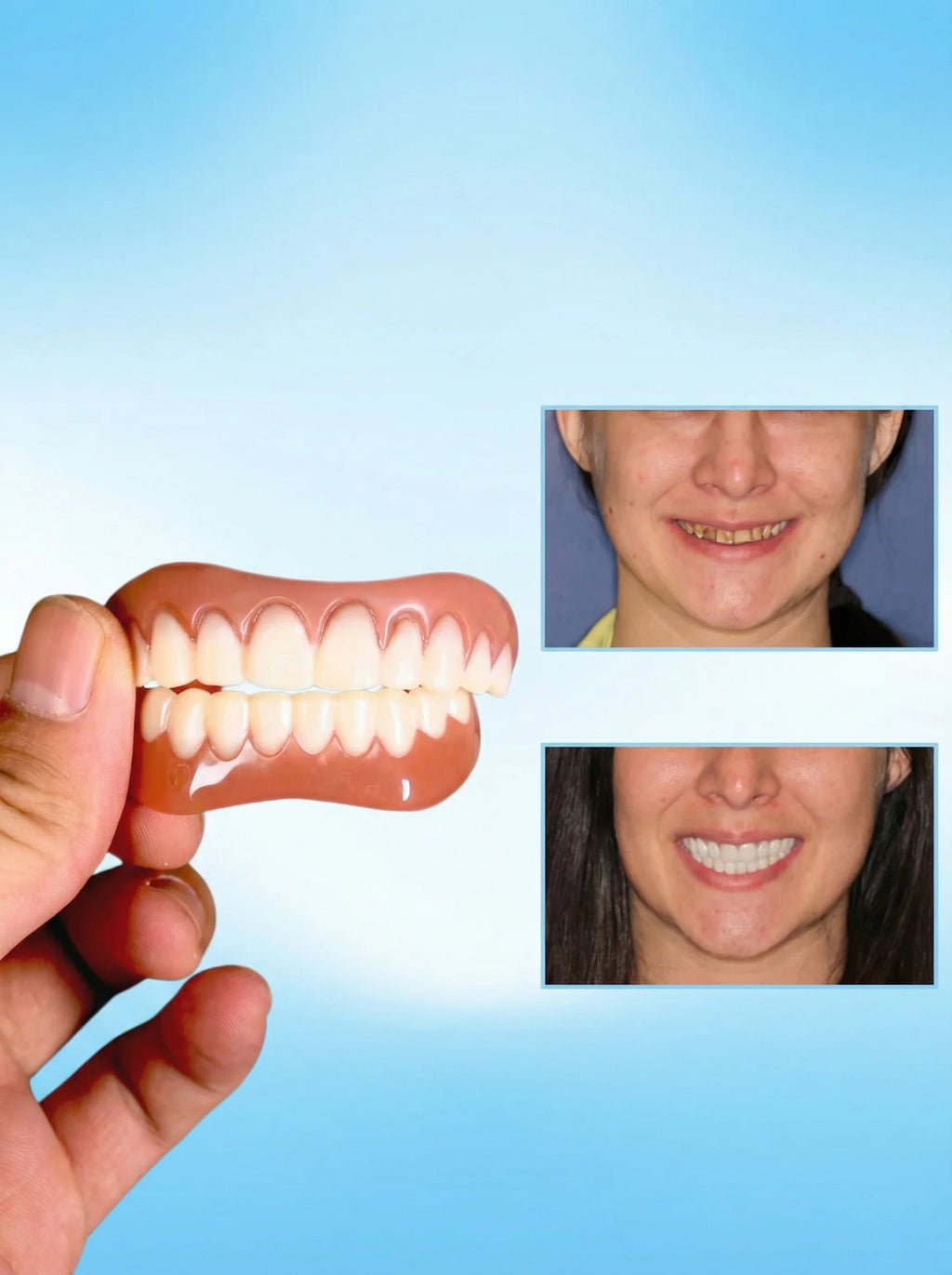 Temporary Veneers | Snap On Veneers-Denture-Pick NewYork